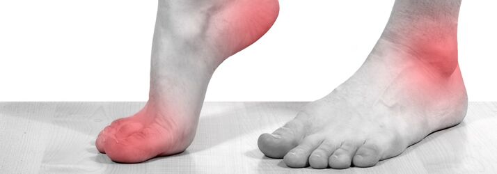 Podiatry Edison NJ Neuromas